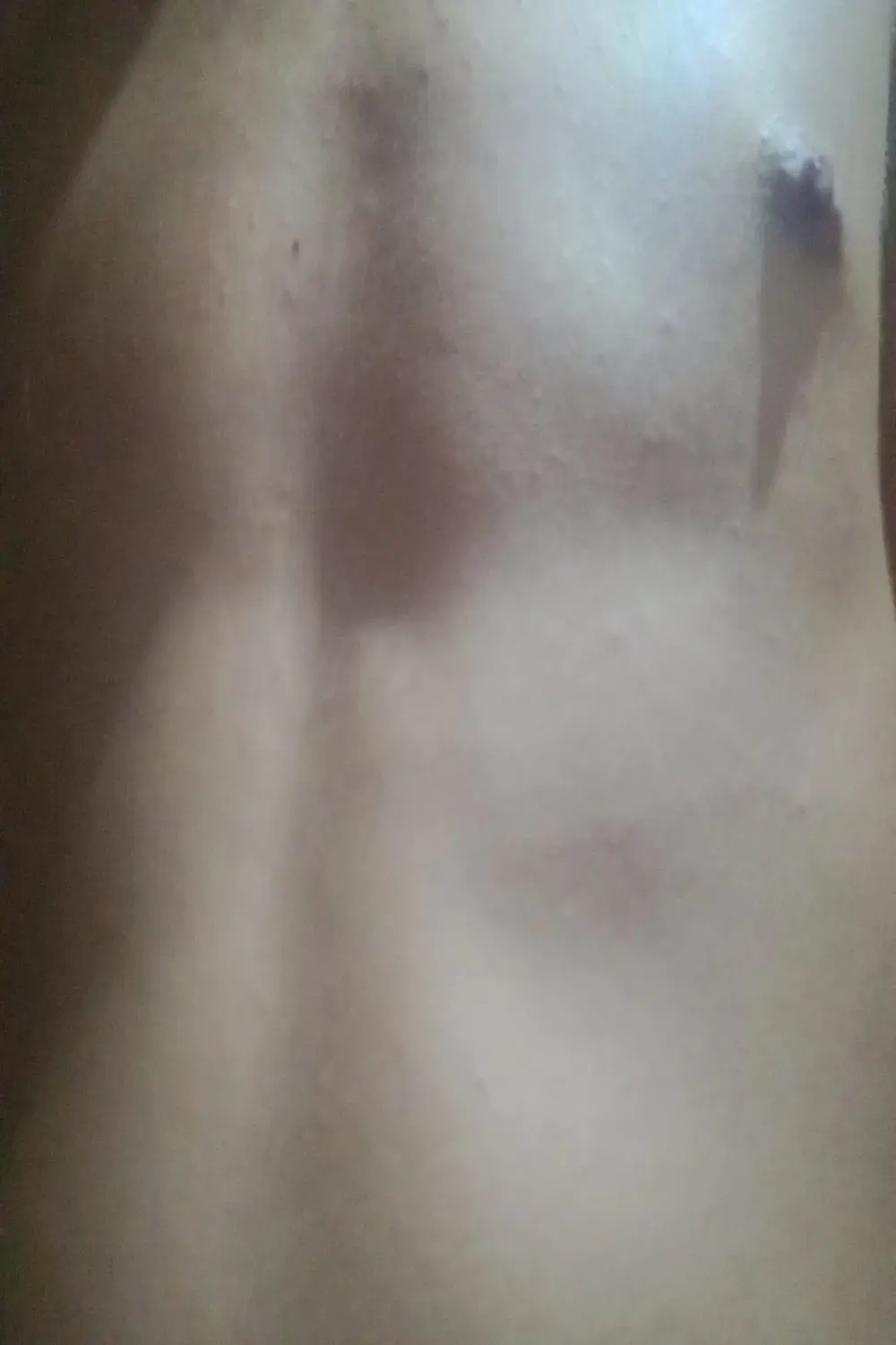 denca28